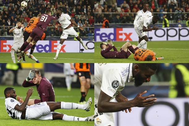 Рюдигеру наложили 20 швов, но его участие в Класико не исключается