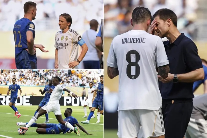 Недостатки, которые Хаби Алонсо должен устранить